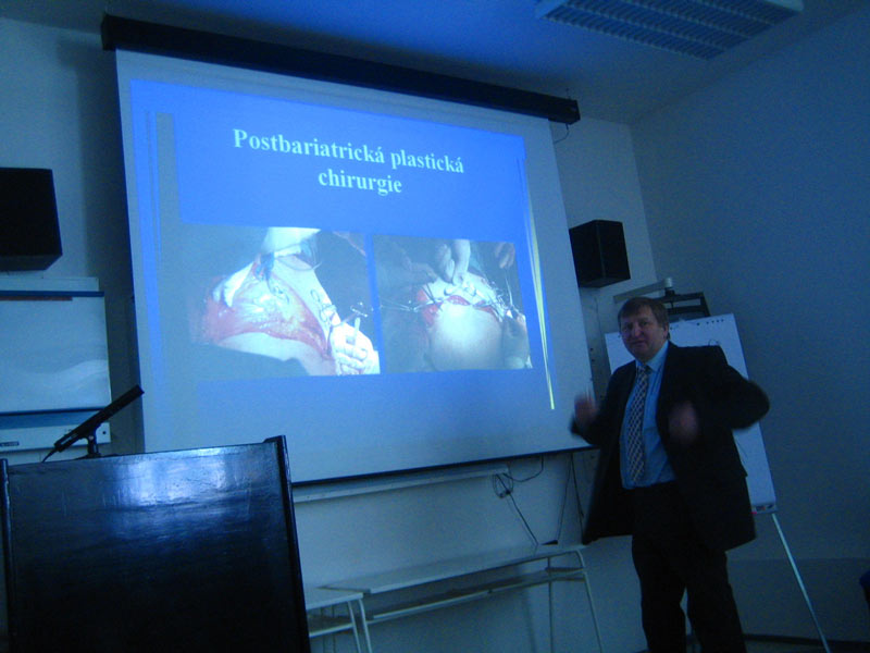 Postbariatrická plastická chirurgie